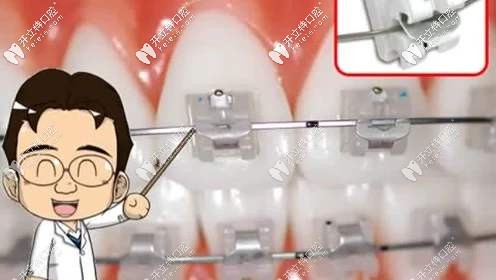 醫(yī)生的技術決定矯正療效