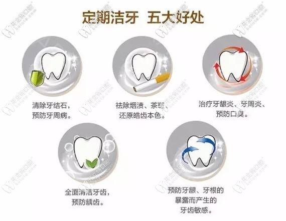 定期潔牙的好處