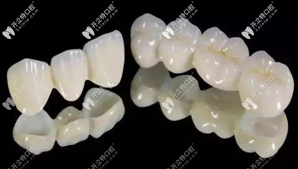 柏樂(lè)口腔全瓷牙冠