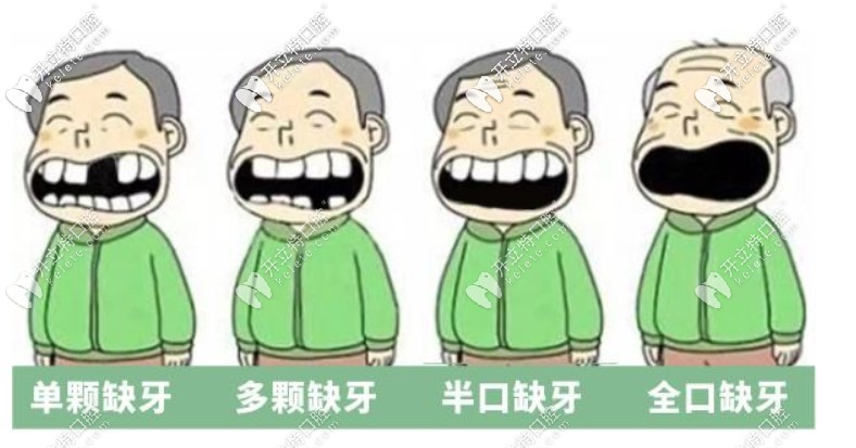 種植牙價(jià)格表