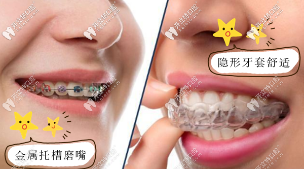 為了美觀舒適選擇做隱適美牙齒矯正 為了美觀舒適選擇做隱適美牙齒矯正