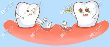 骨量少可以通過(guò)上頜竇提升技術(shù)改善