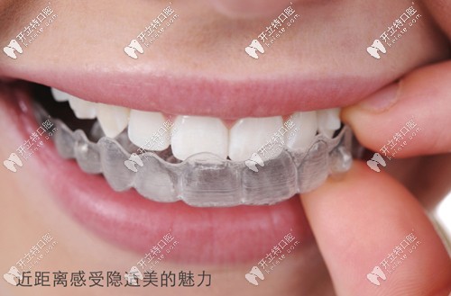 董瑜醫(yī)生是隱適美和時(shí)代天使認(rèn)證醫(yī)師 董瑜醫(yī)生是隱適美和時(shí)代天使認(rèn)證醫(yī)師