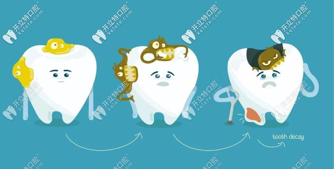 別不信,兒童牙齒齲壞到重度就要做根管治療啦！