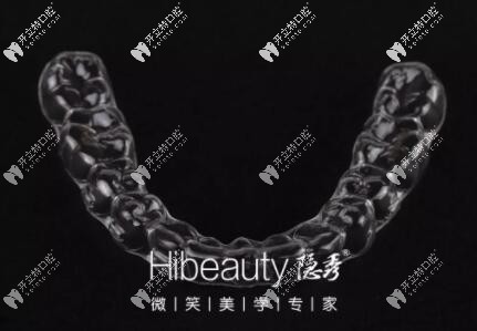 價格貴≠好,國產(chǎn)牙套隱秀和時代天使的這些區(qū)別你知道嗎？