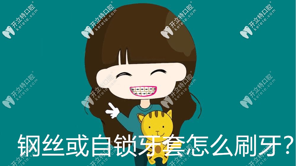 真捉急，剛戴牙套怎么刷牙啊