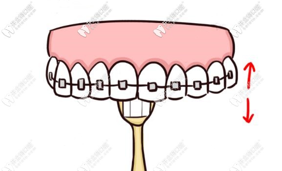 刷牙齒內(nèi)側(cè)