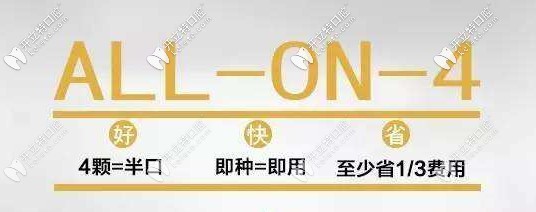 All-on-4種植牙好快省