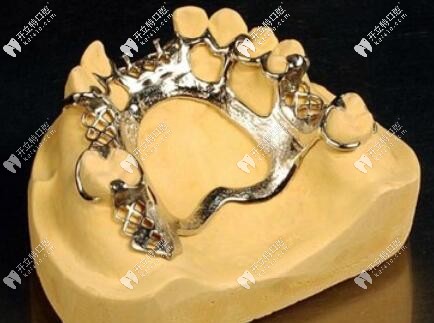 快看這份維他靈支架價(jià)格表,它有2000和2000+之分你知道嗎