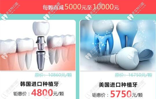 廣大口腔種植牙優(yōu)惠