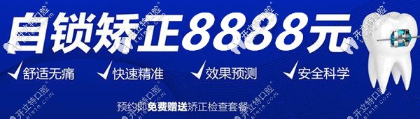 自鎖矯正8888元起 自鎖矯正8888元起