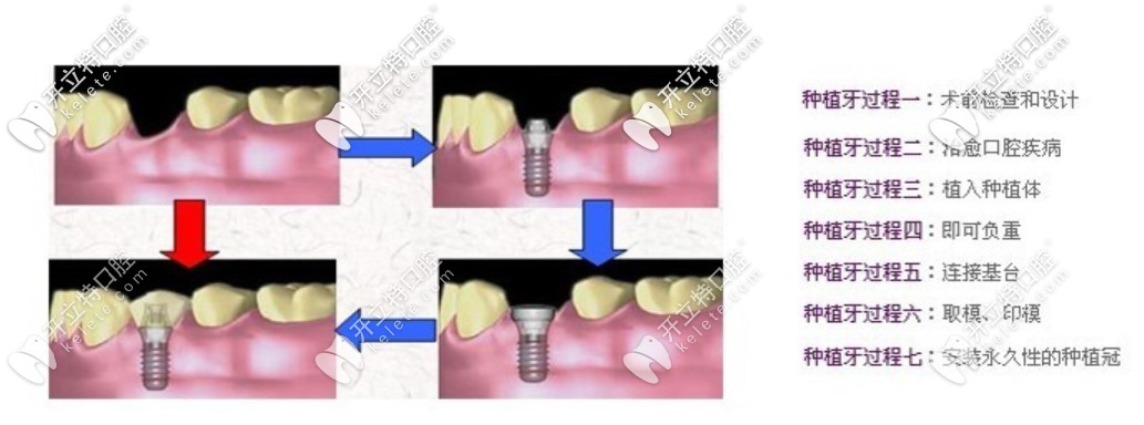 林杰醫(yī)生比較擅長(zhǎng)的項(xiàng)目