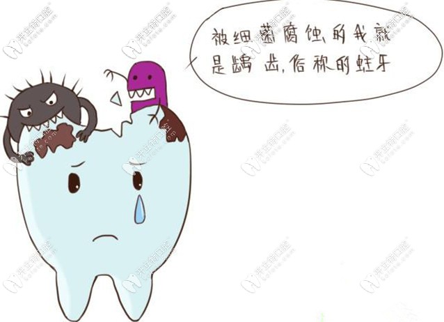 被細(xì)菌輔食就是齲齒俗稱蛀牙 被細(xì)菌輔食就是齲齒俗稱蛀牙