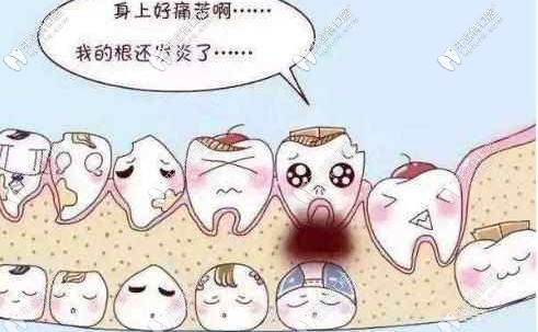 兒童齲齒的常見(jiàn)癥狀以及齲齒是如何產(chǎn)生 兒童齲齒的常見(jiàn)癥狀以及齲齒是如何產(chǎn)生