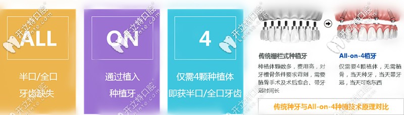 ALL-ON-4種植牙技術(shù)