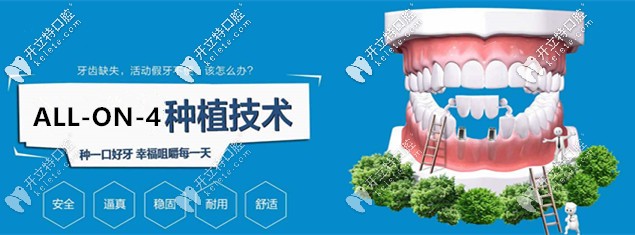 坐標(biāo)東莞，想做ALL-on-4即刻負(fù)重種植牙求推薦靠譜的醫(yī)院！