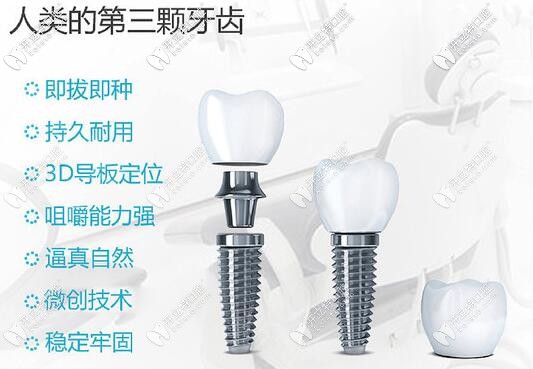 沈陽歡樂仁愛口腔種植牙價格表