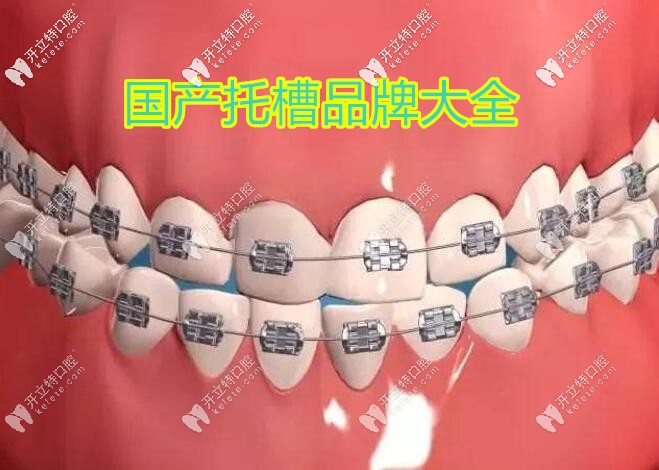 國(guó)產(chǎn)托槽品牌大匯總,你知道價(jià)格貴的和便宜的區(qū)別在哪里嗎