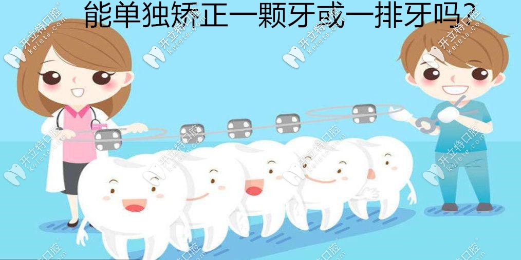 ?牙齒矯正能單獨(dú)矯正一顆歪牙或進(jìn)行一排牙齒正畸嗎？