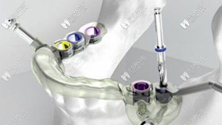 數(shù)字化智慧種植技術