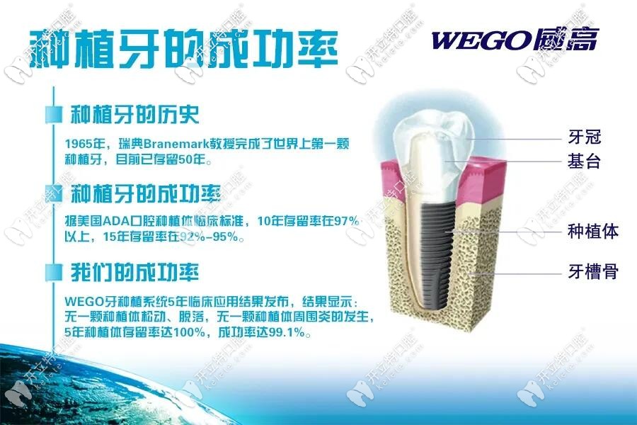 威高種植牙成功率說明