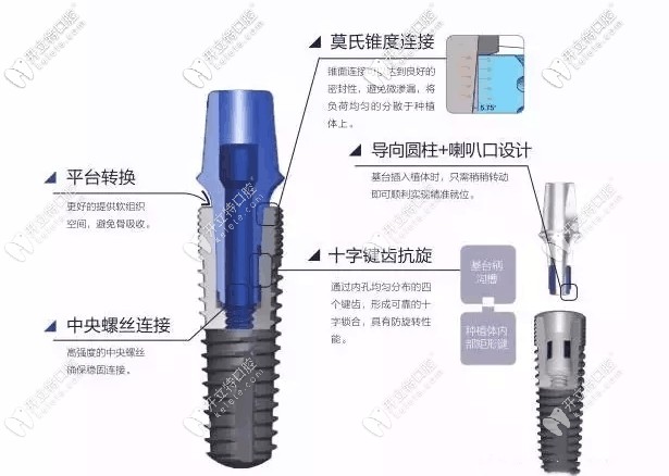 國產(chǎn)威高種植體介紹