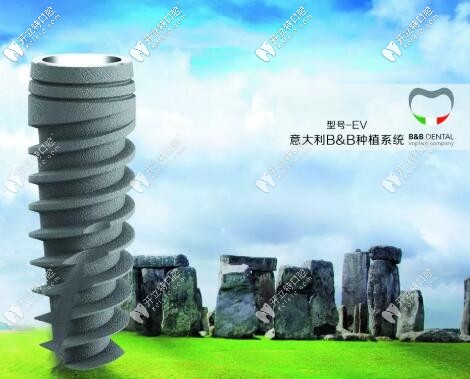 詳解意大利b&b種植體ev和3p的區(qū)別,究竟什么決定著種牙價格