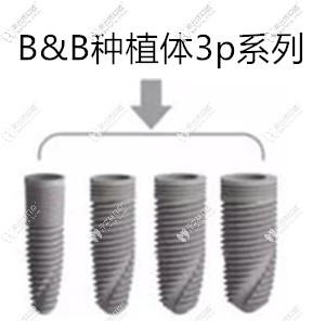 意大利bb種植體3p系列