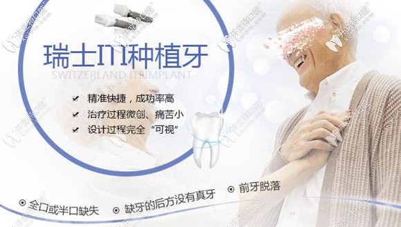 瑞士ITI種植體也叫Straumann士卓曼