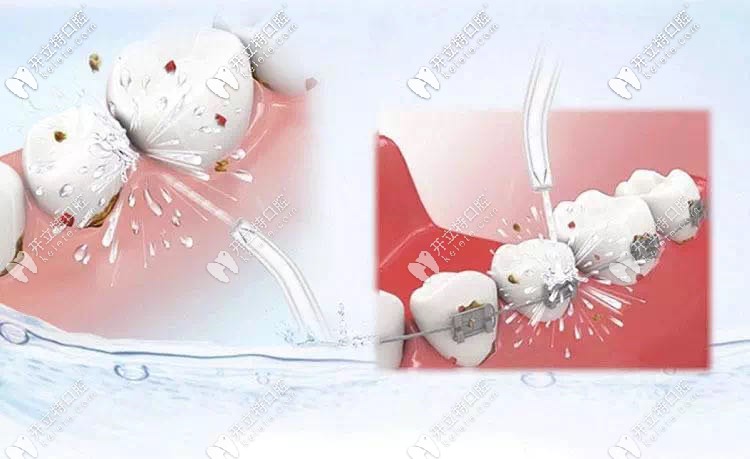 重慶齊美口腔洗牙活動(dòng)