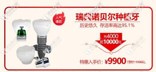 西安諾貝爾齒科瑞典諾貝爾種植體活動價格