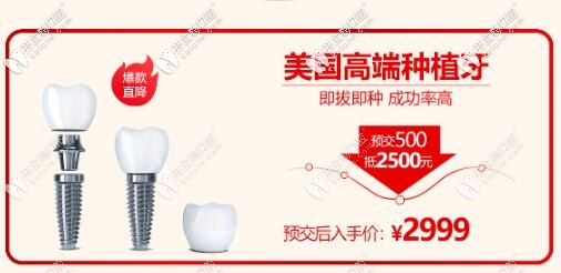 西安諾貝爾口腔門診部美國種植體價格
