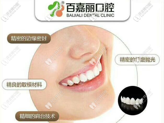 沈陽百嘉麗口腔3D全瓷美容牙冠的優(yōu)勢