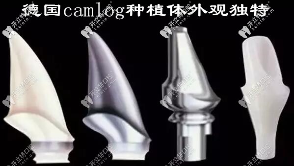 德國(guó)camlog種植牙的價(jià)格貴嗎