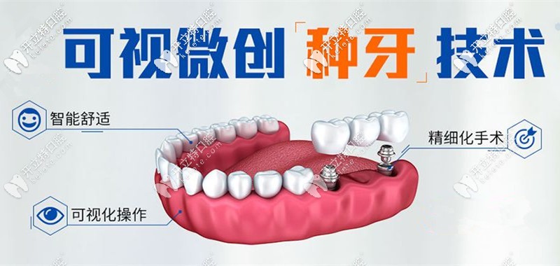 微創(chuàng)種植牙技術(shù)