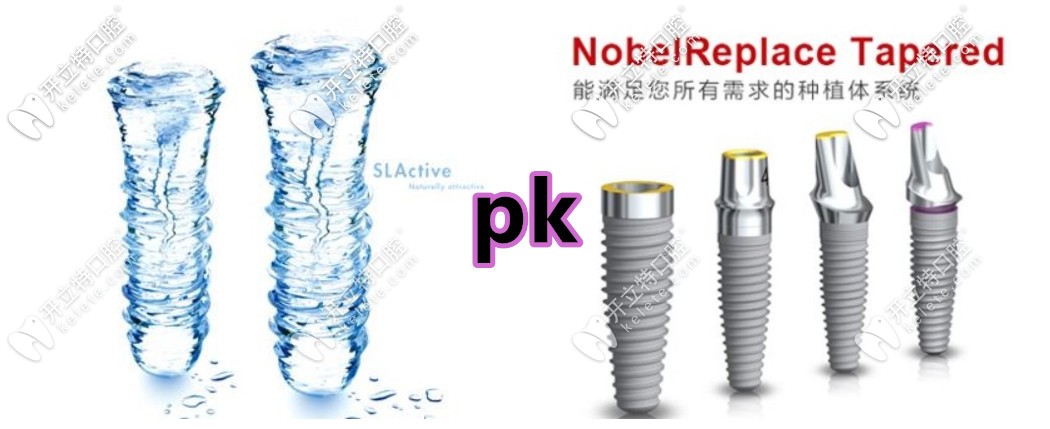 都是上萬的種植牙,諾貝爾active和iti鈦鋯親水種植體哪個(gè)更好