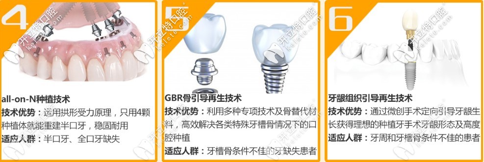 all-on-N種植技術(shù)和上頜竇提升術(shù)優(yōu)勢(shì)