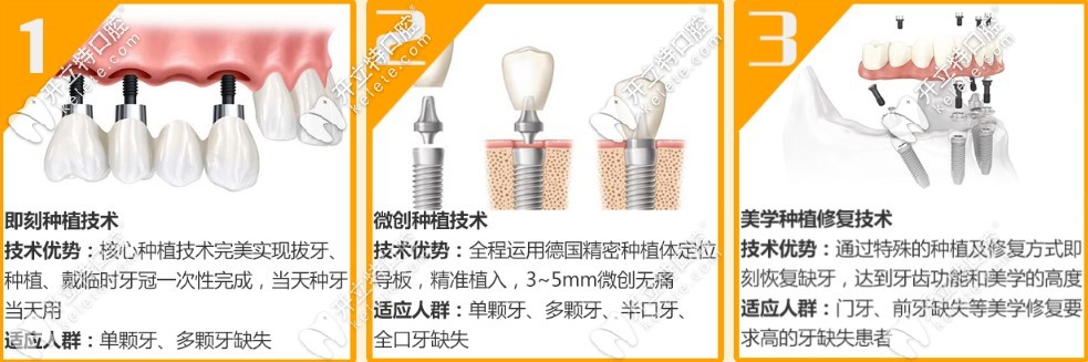 昆明柏德口腔即刻種植牙及微創(chuàng)種植牙技術(shù)
