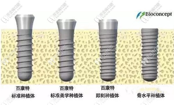 國(guó)產(chǎn)百康特種植體