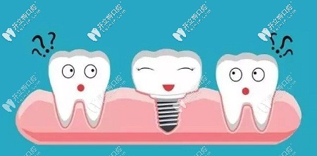 種植牙與真牙無差