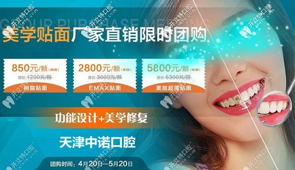 天津的妞們來美牙啦!廠家直銷的EMAX和美加超薄瓷貼面隨你選