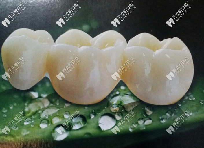 二氧化鋯全瓷牙價(jià)格