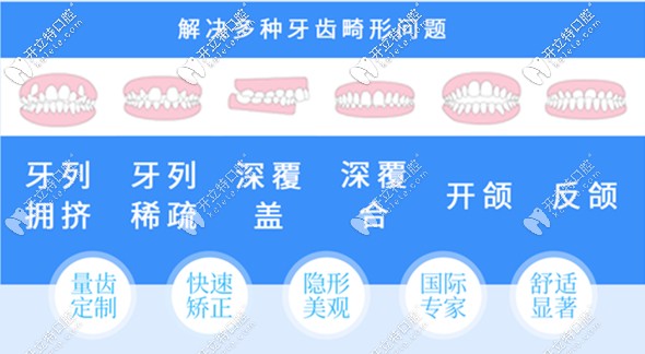 濰坊隱形牙齒矯正價(jià)格