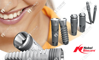 諾貝爾不同型號(hào)的植體