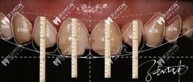 瓷貼面設(shè)計(jì)