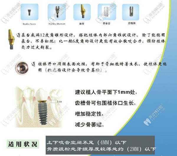 美國(guó)歐妮泰種植牙品牌適應(yīng)癥