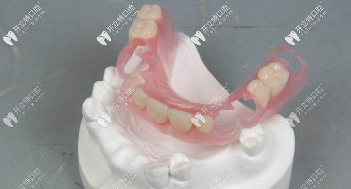 美觀度高的隱形義齒