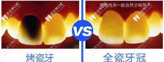 分析兩者的區(qū)別 分析兩者的區(qū)別