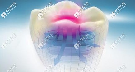 全瓷牙和烤瓷牙的區(qū)別大嗎 全瓷牙和烤瓷牙的區(qū)別大嗎