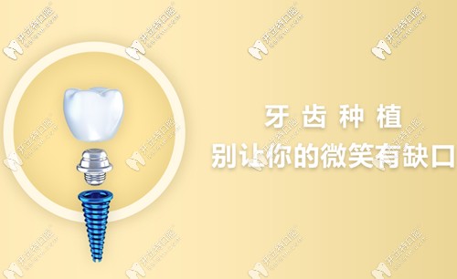 <!--<i data=20240703-sp></i>-->民尤其擅于微創(chuàng)種植手術(shù) <!--<i data=20240703-sp></i>-->民尤其擅于微創(chuàng)種植手術(shù)